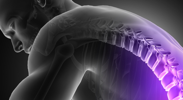 Articular InSpiNe
